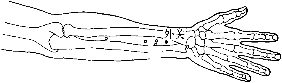 第二节 头痛